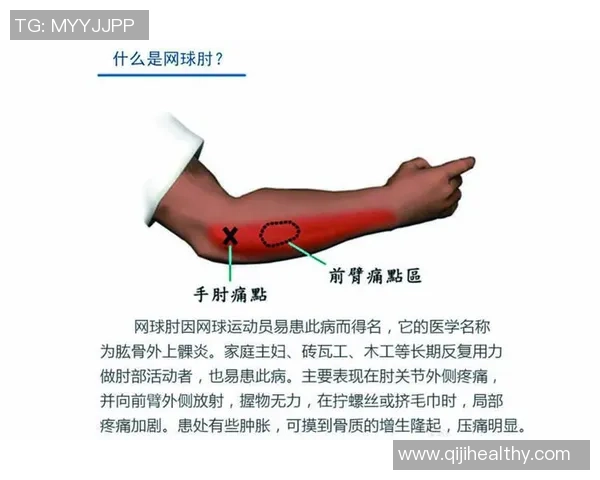 成都网球队技术分析与提升策略探讨助力网球运动发展 成都网球队技术分析与提升策略探讨助力网球运动发展